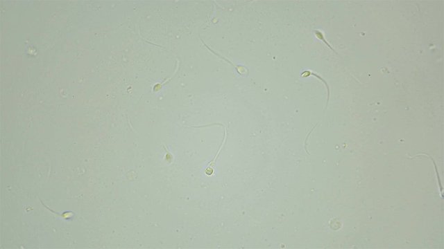 Human sperm under a microscope (spermatozoa), consists of sperm and seminal fluid, also contains various substances: antibodies, cholesterol, choline, citric acid, fructose and DNA ...