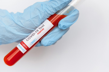 Obraz premium Coronavirus covid 19 infected blood sample in tube in hand of scientist on white background. New virus covid-19 vaccine research.