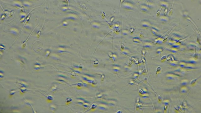 Human sperm under a microscope (spermatozoa), consists of sperm and seminal fluid, also contains various substances: antibodies, cholesterol, choline, citric acid, fructose and DNA ...