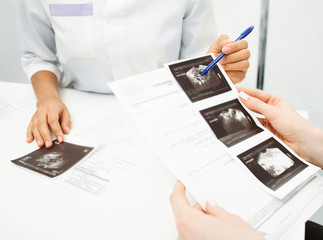 Ovaries exam, ultrasound diagnosis of pelvic organs. Transvaginal ultrasound for exam ovaries cyst and uterine polyps