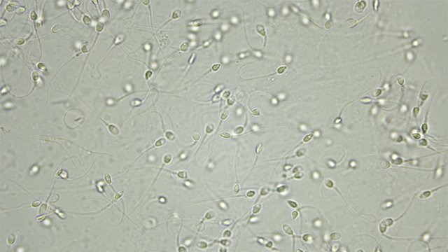 Human sperm under a microscope (spermatozoa), consists of sperm and seminal fluid, also contains various substances: antibodies, cholesterol, choline, citric acid, fructose and DNA ...