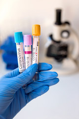 Coronavirus blood test in hospital laboratory. Covid-19 test