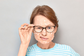 Portrait of annoyed girl with white drops of face cream on skin