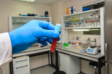 Blood testing in the laboratory.