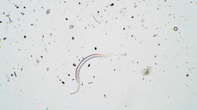 Roundworm nematode moves in fresh water under a microscope close up. Theme of laboratory biological research under microscope. Microscopic protozoa with a visible organ system in a drop of water.