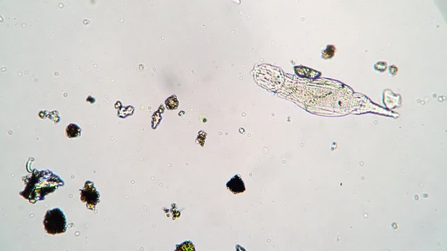 Microscopic animal rotifer in drop of water from pond under a microscope. Theme of laboratory biological research under microscope. Microscopic protozoa with a visible organ system in drop of water.