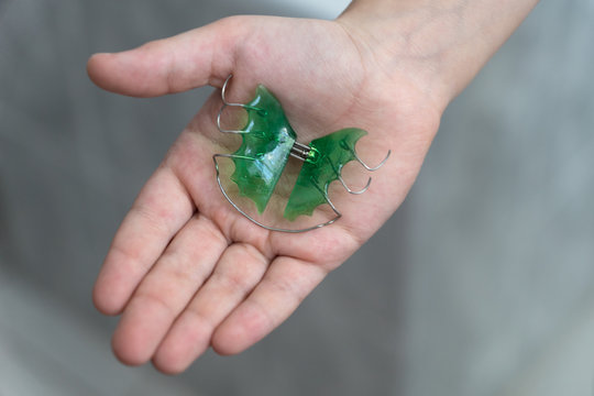 child's hand holds green children's orthodontic plaques for orthodontic bite correction, healthcare concept