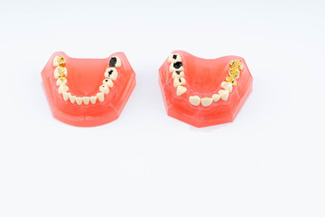 Dental education and study model of teeth.