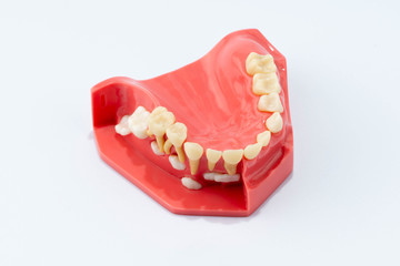 Dental education and study model of teeth.