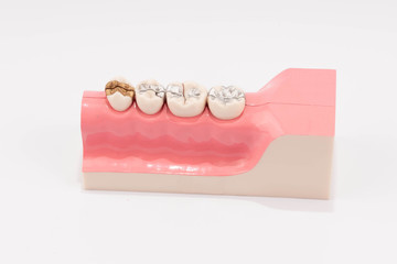 Dental education and study model of teeth.