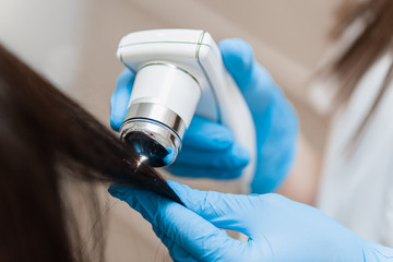 Trichoscopy of hair and scalp closeup. Trichoscope in the hands of a doctor - obrazy, fototapety, plakaty