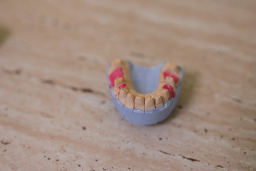 dental prosthesis at the dentist with teeth and masses prepared for clients