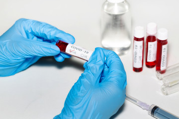 Medical examiner in a laboratory holds a blood sample of a positive corona virus patient in India