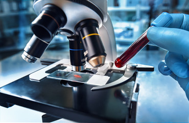 microscopist working in the laboratory with blood sample for analysis in the microscope / doctor...