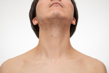 髭脱毛　beforeイメージ　3日間処理してない髭