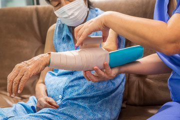 Osteoporosis splint with an elastic bandage is applied to help keep the splint in place