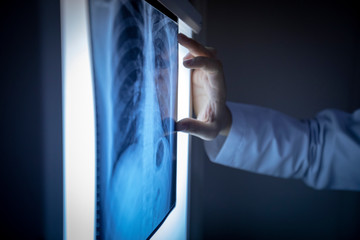 Doctor checking x ray film and examining lungs