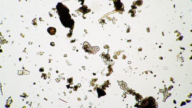 Micro animal water bear moves quickly in dirty water from moss under a microscope. Theme of laboratory biological research under microscope. Microscopic animal in a drop of water under magnification.