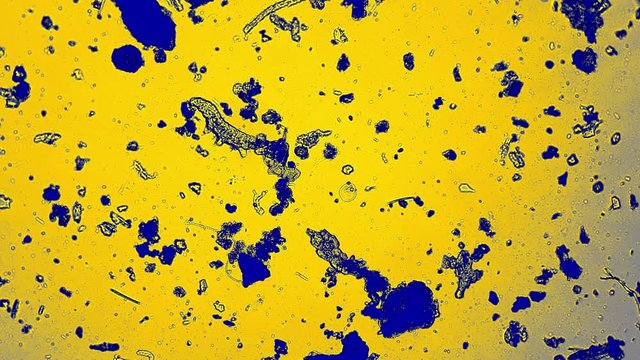 The tardigrade is swimming between dirt pieces in blue and yellow colors. Moss piglet is wagging it's paws trying to move and the other bacteria floats near it. Theme of the microcosmos.
