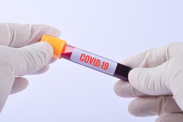 hand hold covid-19 blood test tube