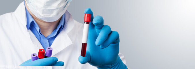 Coronavirus 2019-nCoV Blood Sample.