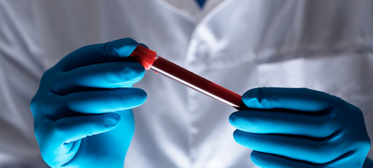 Coronavirus 2019-nCoV Blood Sample.