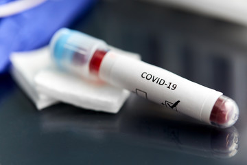 medicine, healthcare and pandemic concept - close up of beaker with positive coronavirus blood test on table at laboratory