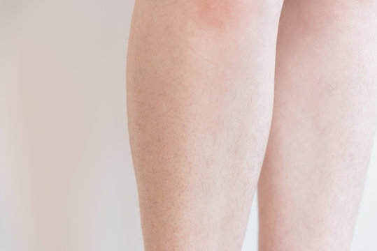 Female legs covered with hair. The legs were overgrown during the period of self-isolation. Humor and body positivity. Coronavirus.