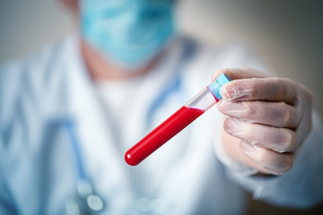 The epidemic of coronavirus. Hand of a doctor holding a bottle of blood sample.