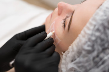 Beautician draws the contours of a white pencil on the face of the patient. Schematic marking before contouring. Close-up preparation of the face for cosmetic plastic surgery