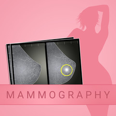illustration of woman's mammogram