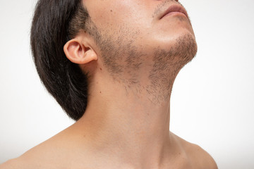 Obraz premium 髭脱毛 beforeイメージ 1週間処理してない髭