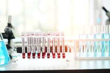 coronavirus covid 19 check, researchers are finding ways to eliminate the corona virus vaccine....