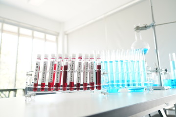 coronavirus covid 19 check, researchers are finding ways to eliminate the corona virus vaccine....