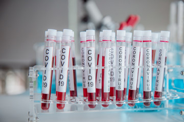 Focus one blood sample in the tube. 
Close-Up on Covid 19 blood tube for Vaccine research in Laboratory on background of Scientific Lab.