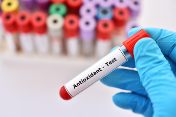 Test tube contain with blood sample for antioxidant test