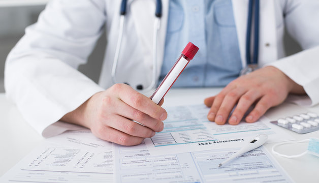 Man doctor with blood test tube in hands