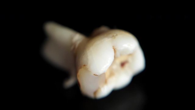 Pulled out baby tooth on a black background. Extracted tooth isolated on black. Macro