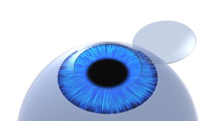 Corneal flap eye illustration. Isolated on white. 3D-rendering.