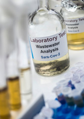 Wastewater samples, analysis of sars-cov-2 virus in patients infected by human coronavirus 229E, conceptual image