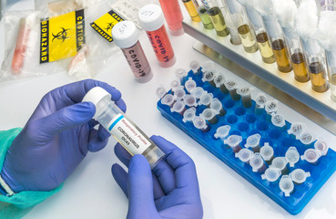 Scientist holds vial with sample of coronavirus OC43 in a specialized laboratory, conceptual image