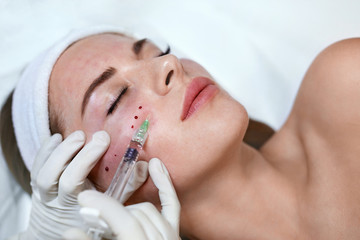 Face Treatment. Beauty Injection Near Eyes. Female Skincare  Procedure In Cosmetic Clinic. Beautician Hands In Gloves With Syringe.