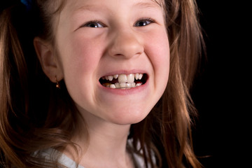 Little girl shows crooked teeth on a black background.