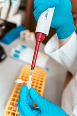 Close-up photo of lab technician working with micropipette and samples.