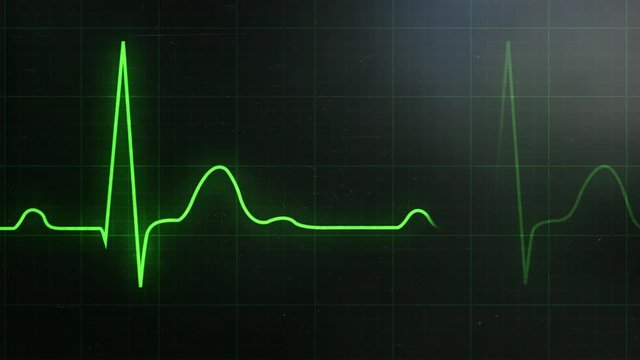 Loop EKG Heart Rate In Normal Sinus Rhythm. Green Beat Line On The Monitor. Graph Of Electrical Activity Related To The Cardiac Contractions And Grid Scale With Axes For The Interpretation Of ECG Wave