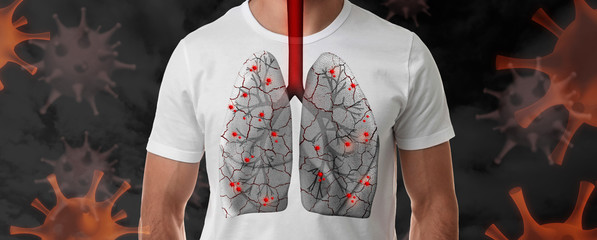 Man with diseased lungs surrounded by viruses on dark background