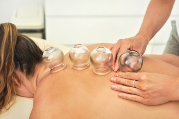 Young female physiotherapist applying glass suction banks on back of her patient, during cupping...