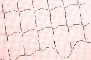 Cardiogram close-up, top view
