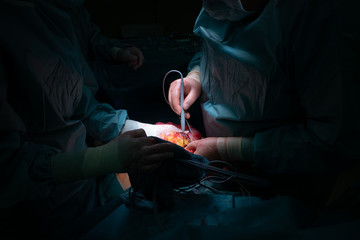 a surgical team performs a surgical abdominal operation