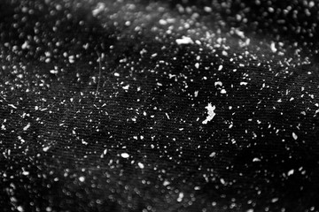 Dandruff on black shirt